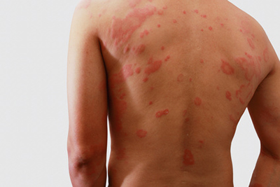 dermatologia